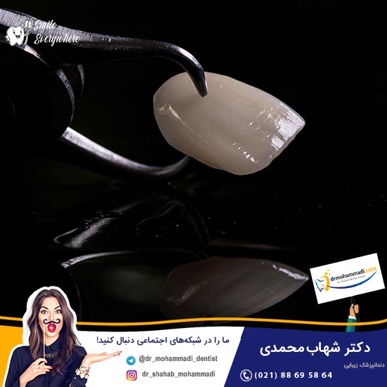 بازیگران ایرانی که لمینت دندان انجام داده اند - کلینیک دندانپزشکی دکتر شهاب محمدی